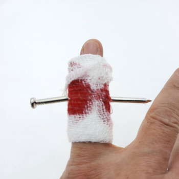 ÇİVİLİ PARMAK - 24Lİ